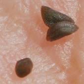 �J�L�l�K���V